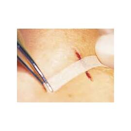 Plasture pentru inlocuirea suturilor chirurgicale  OMNISTRIP - - Roveli